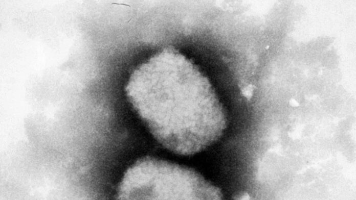 Affenpockenvirus unter dem Mikroskop